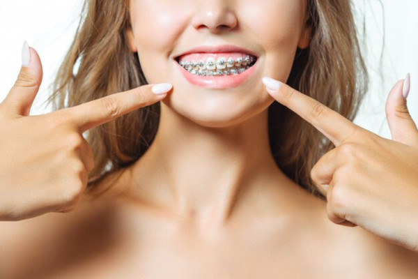 Promove o alinhamento dos dentes